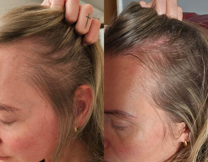 Crown & Bloom™ - Follicle Stimulating + DHT Blocking Botanical Hair Growth Serum