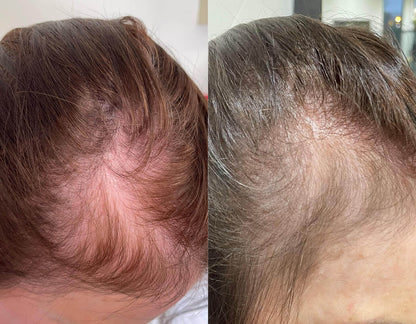 Crown & Bloom™ - Follicle Stimulating + DHT Blocking Botanical Hair Growth Serum